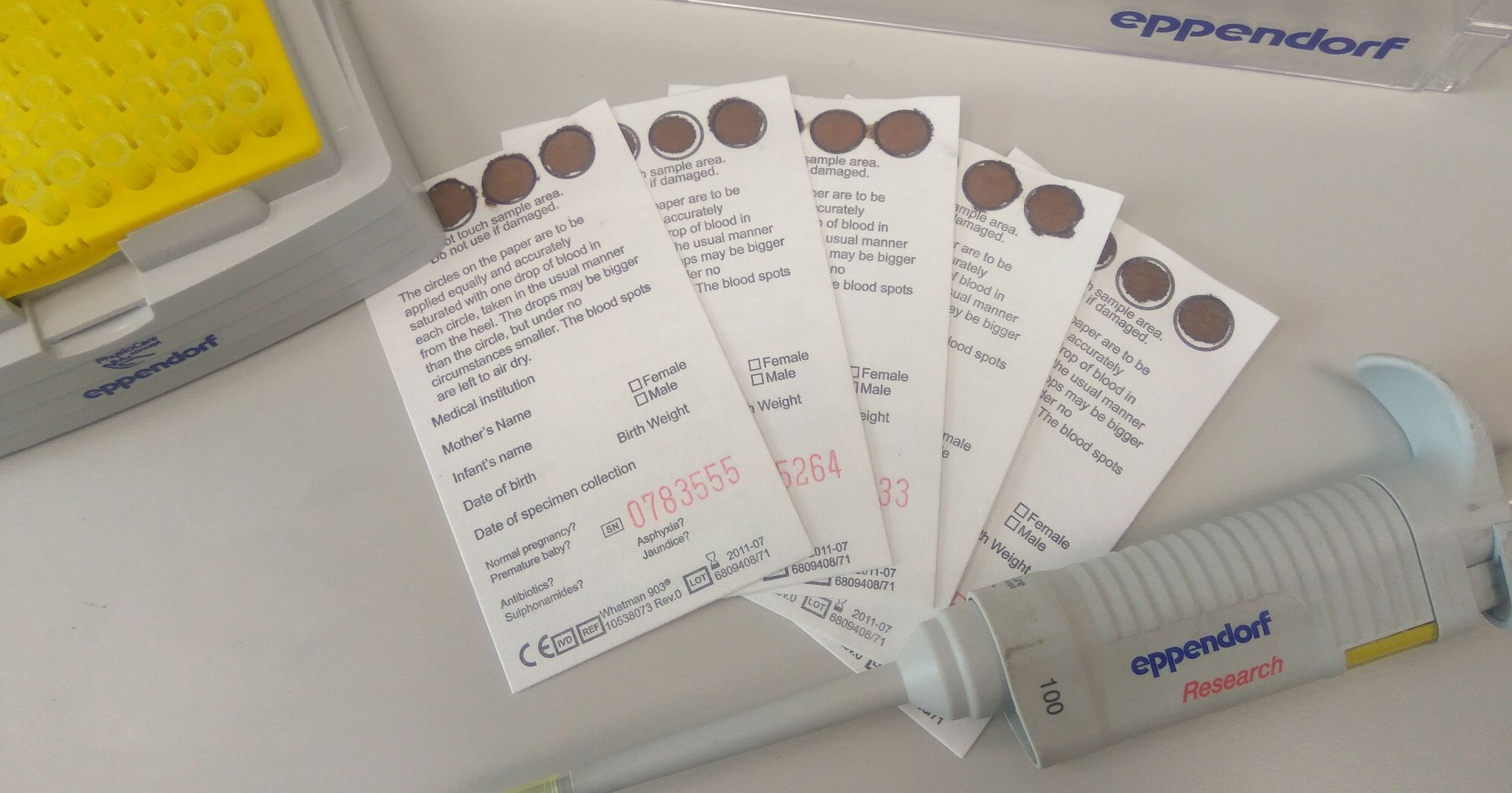 Врождённые аномалии будут диагностировать по сухим пятнами крови Врождённые аномалии будут диагностировать по сухим пятнами крови