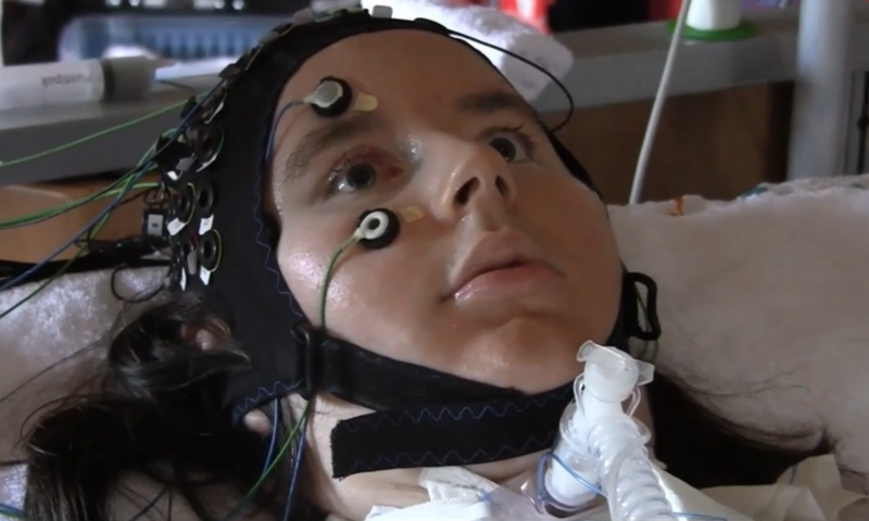 Результаты проекта по созданию нейроинтерфейса для полностью парализованных пациентов поставили под сомнение - 2 Результаты проекта по созданию нейроинтерфейса для полностью парализованных пациентов поставили под сомнение - 2