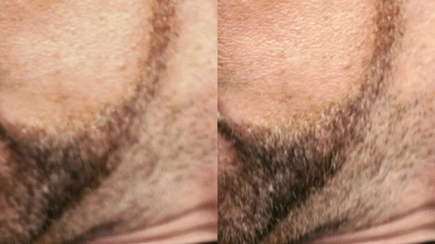 Почему от 3D болит голова - Часть 8 Расфокус и будущее 3D - 32 Почему от 3D болит голова - Часть 8 Расфокус и будущее 3D - 32