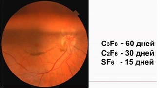 Витрэктомия – бороздим просторы мира, ограниченного полостью глаза - 14 Газы для витреоретинальной хирургии