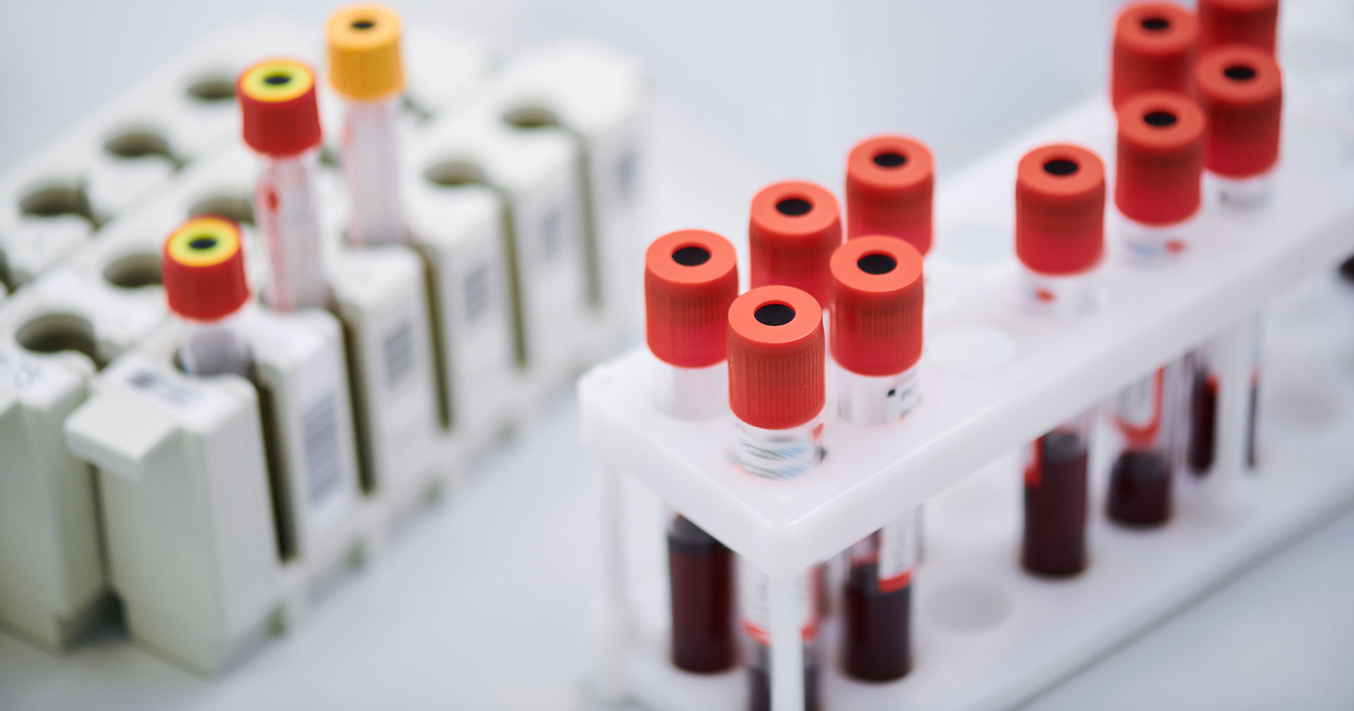 Капля крови поможет обнаружить 13 разновидностей рака Капля крови поможет обнаружить 13 разновидностей рака