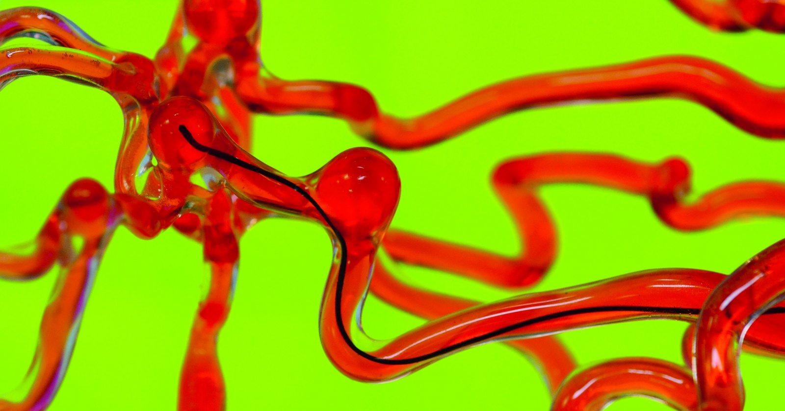 В лабиринте сосудов: новый способ борьбы с тромбами В лабиринте сосудов: новый способ борьбы с тромбами