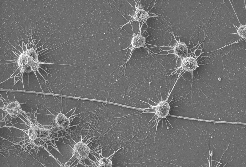 Как живут там, где почти никто не живет: темная сторона биосферы