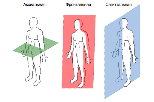 Альтернативный метод транспедикулярной фиксации или как штангенциркуль может заменить целый рентгеноаппарат - 4