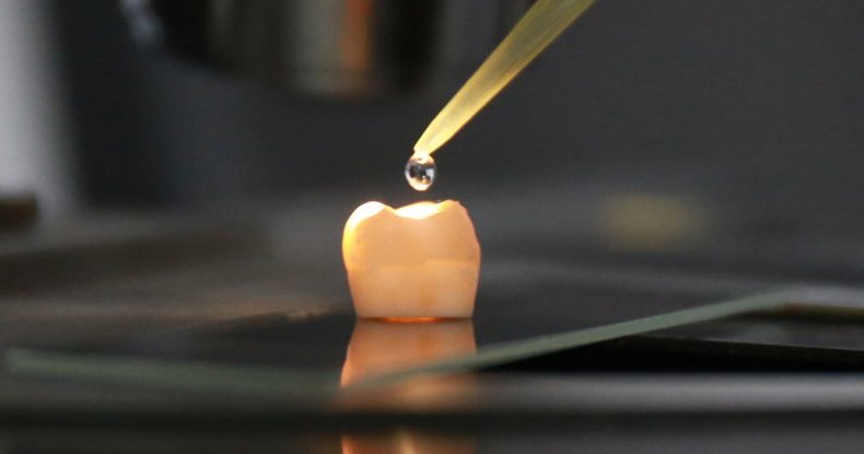 Изобретен способ восстановить зубную эмаль: никаких пломб