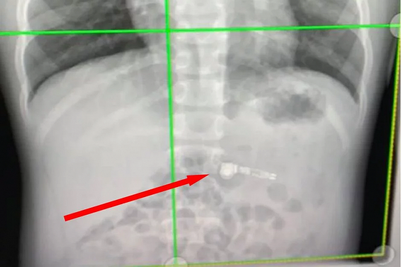 Apple AirPods стали настоящим кошмаром вместо рождественского подарка - 1 Apple AirPods стали настоящим кошмаром вместо рождественского подарка