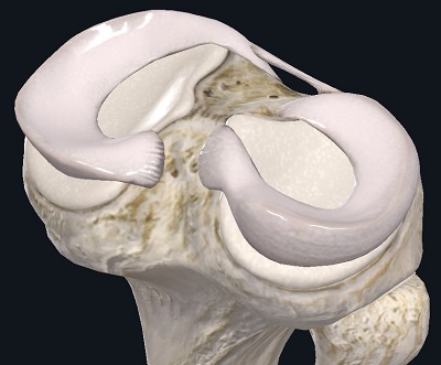 Мениски в коленном суставе — что это, зачем это, как это лечится если повредилось? - 1