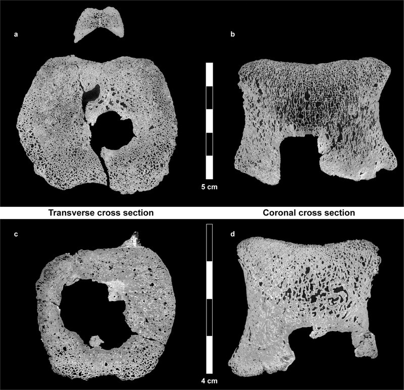 Редкий вид человеческого рака нашли на хвосте динозавра