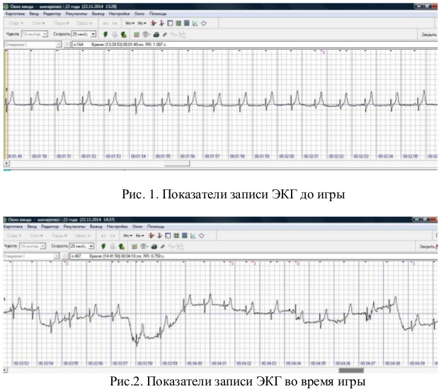 Мелкомоторная блокировка дыхания в компьютерном спорте (МКМ) - 5 image
