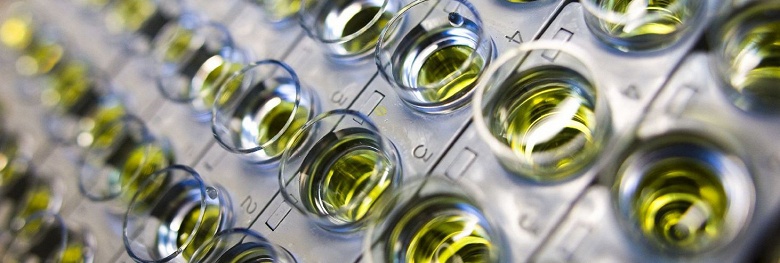 В Швейцарии создан новый тест на коронавирус, работающий в 10 раз быстрее существующих - 1 В Швейцарии создан новый тест на коронавирус, работающий в 10 раз быстрее существующих