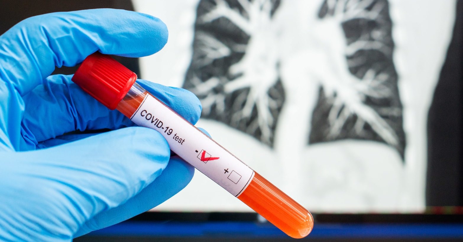 «Яндекс» начал доставку тестов на коронавирус