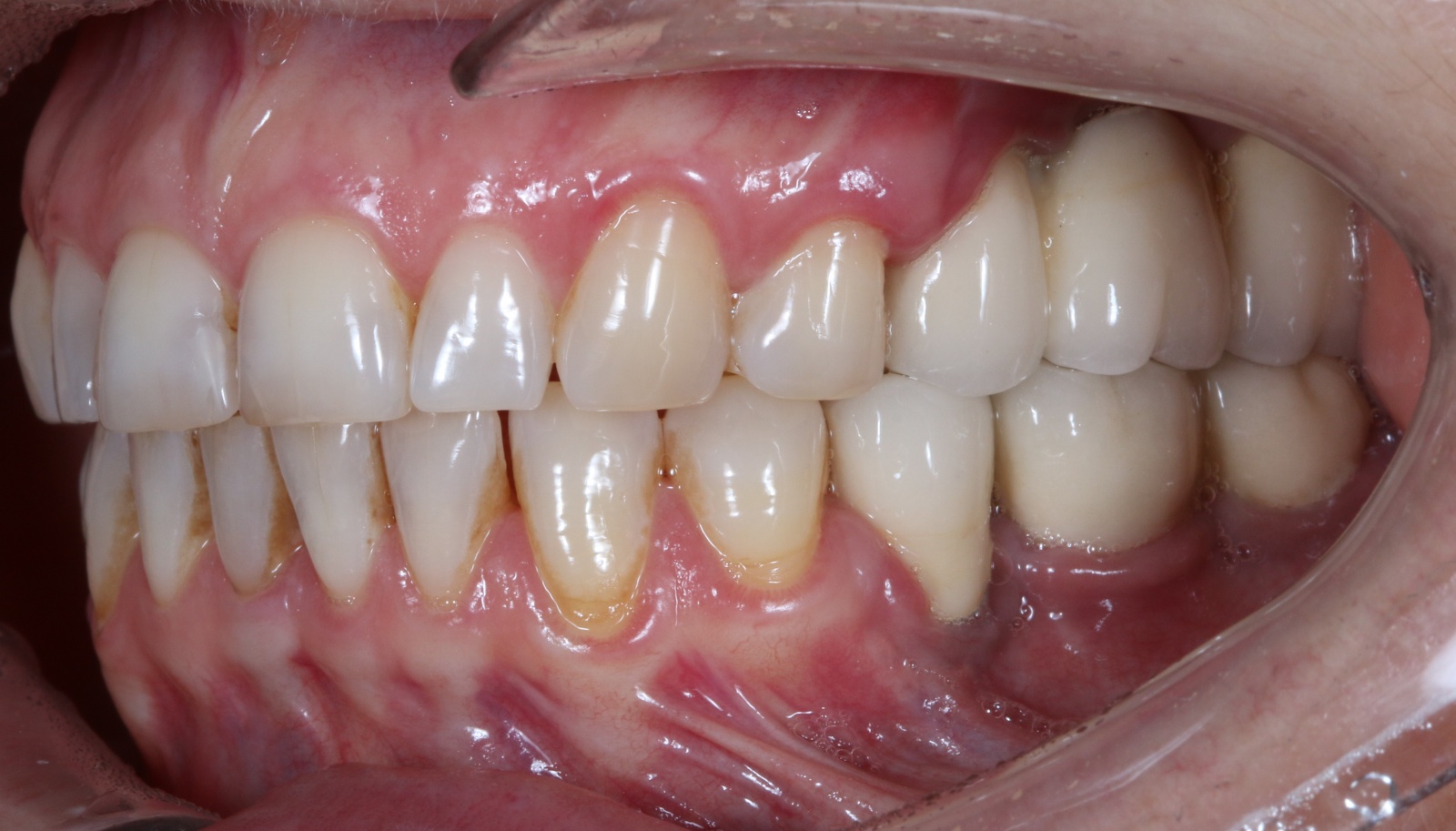 Стоматология: ожидание и реальность - 10 image