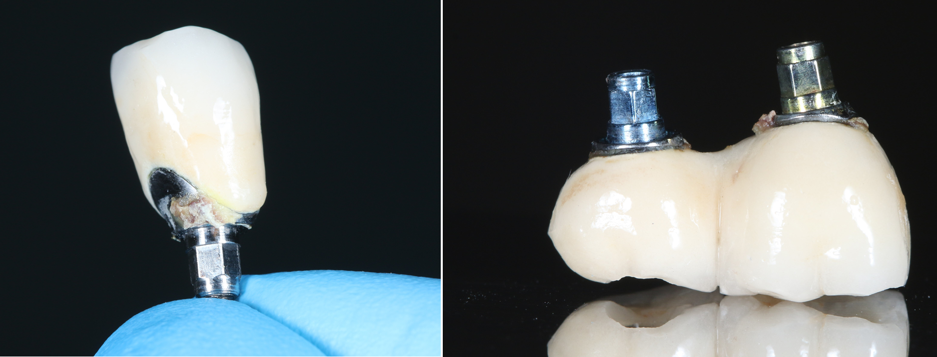 Стоматология: ожидание и реальность - 11 image