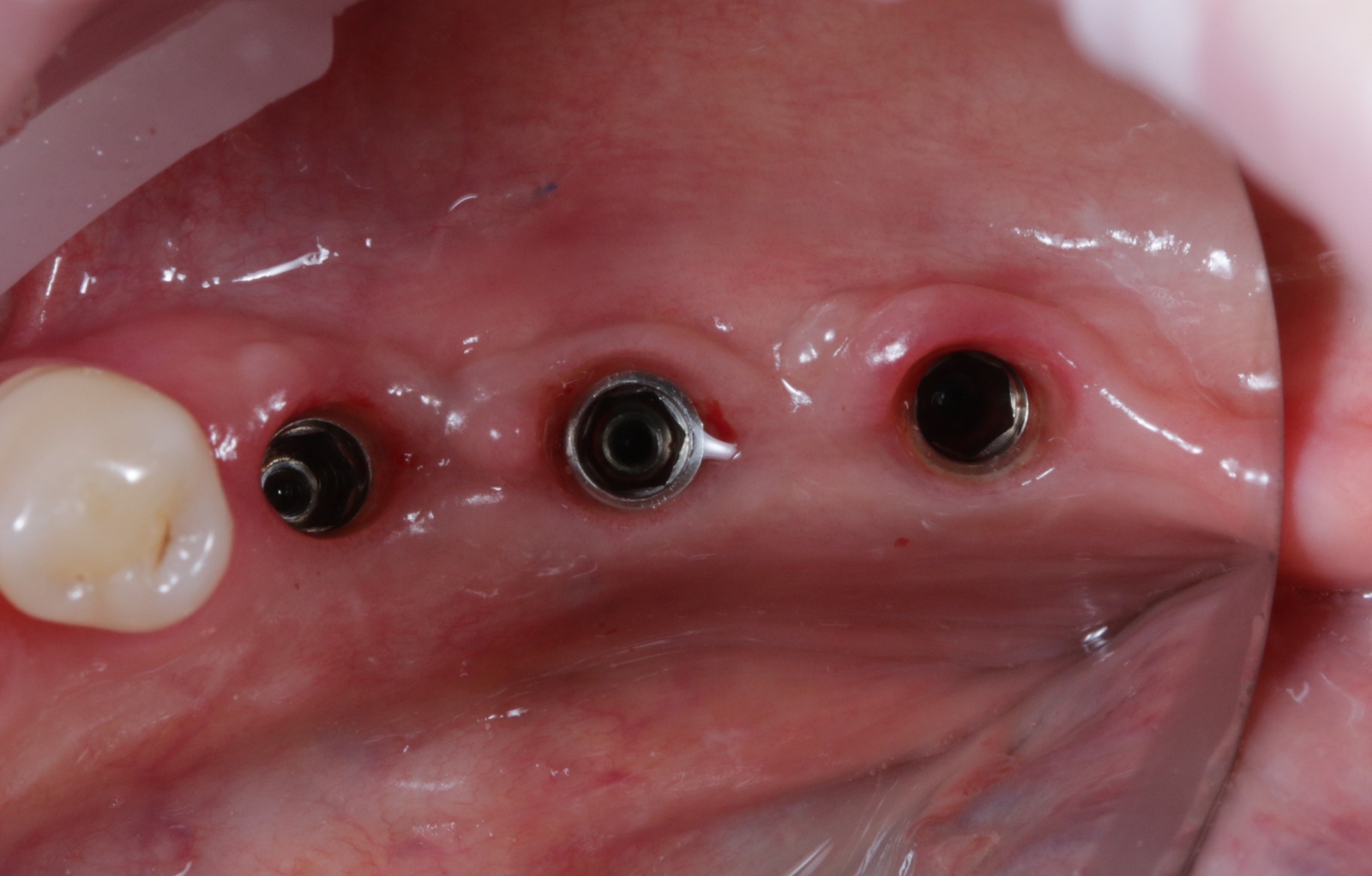 Стоматология: ожидание и реальность - 15 image