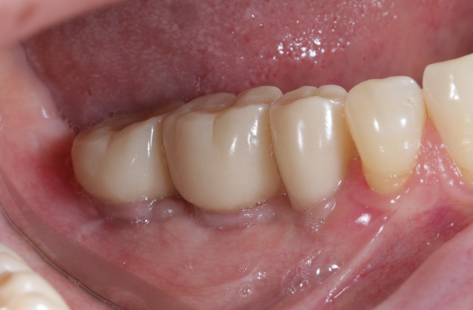 Стоматология: ожидание и реальность - 16 image