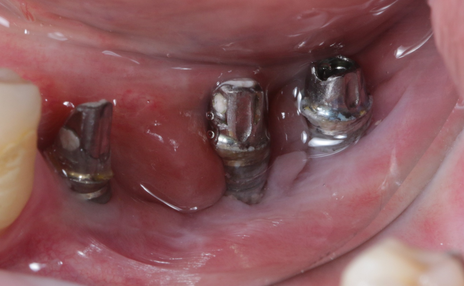 Стоматология: ожидание и реальность - 20 image