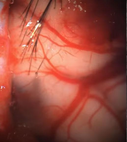 Слияние человека и машины. Neuralink - 5 Слияние человека и машины. Neuralink - 5