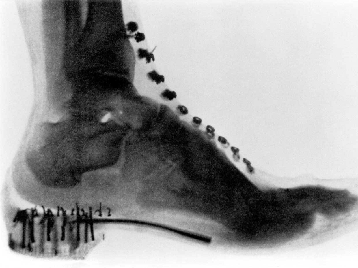 Опасности покупки обуви в эпоху популярности рентгеновских лучей - 3
