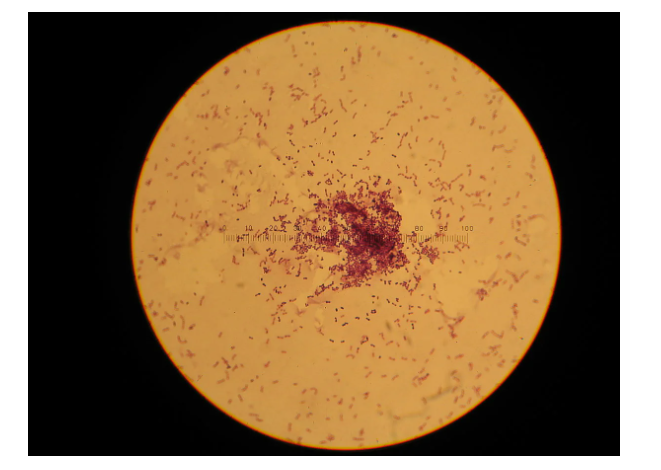 Молоко: пастеризация, туберкулез и болезни ЖКТ - 8