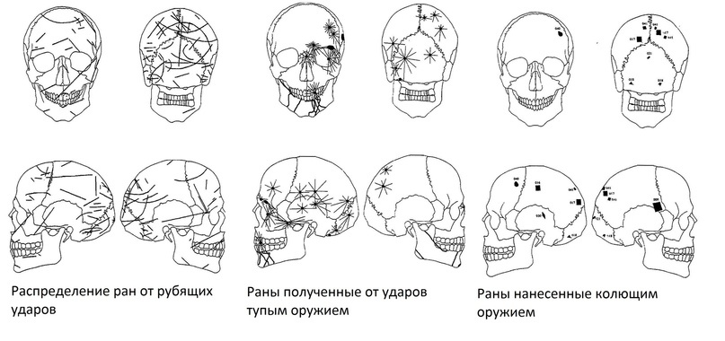 Изнанка войны. Средневековые (и не только) ранения - 11