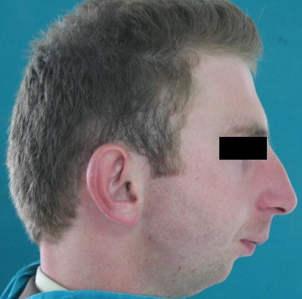 Что вам нужно знать про молочные зубы у детей (и современный медицинский подход) - 3 image