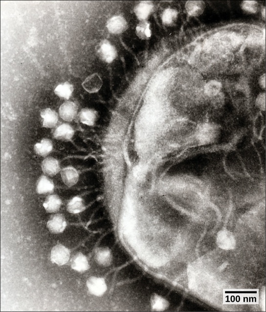 Figure 2: Bacteriophages attached to a host cell (transmission electron micrograph). In bacteriophage with tails, like the one shown here, the tails serve as a passageway for transmission of the phage genome. (credit: modification of work by Dr. Graham Beards; scale-bar data from Matt Russell)