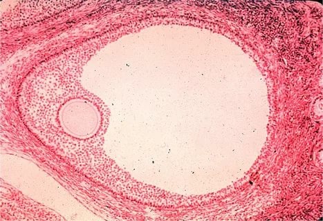 Граафов пузырёк. В правой части снимка по центру — яйцеклетка.