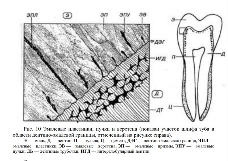 Флюороз — противоположность кариеса (и проверьте, что за воду вы пьёте) - 5