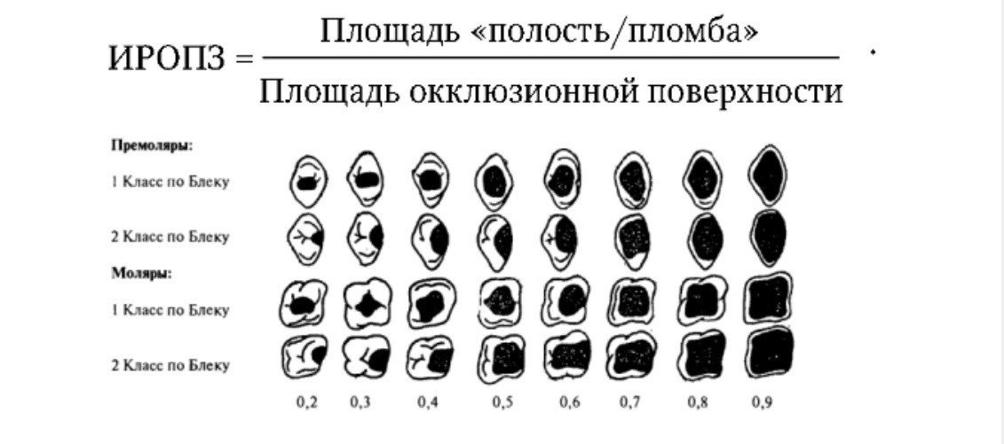 Хорошая пломба vs плохая пломба - 5