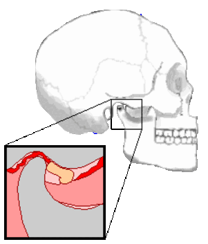 Щелчки в суставе - 5 Щелчки в суставе - 5