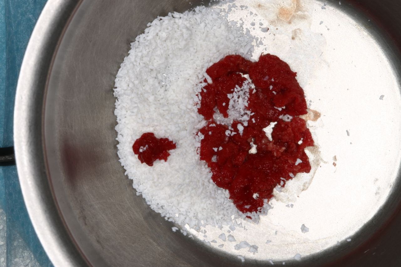 Случай девушки без трёх зубов: как наращивается кость перед установкой импланта; зачем и как организм меняет скелет - 3 Случай девушки без трёх зубов: как наращивается кость перед установкой импланта; зачем и как организм меняет скелет - 3