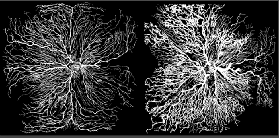 Слева – сосудистая система извозчика, справа – профессора математики П.А. Некрасова Слева – сосудистая система извозчика, справа – профессора математики П.А. Некрасова