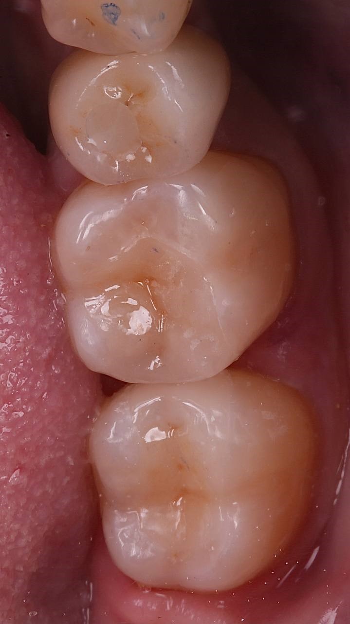 Как понять, что стоматолог адекватный - 13