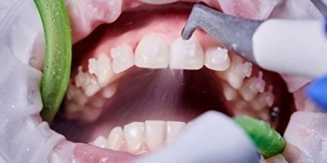 Как понять, что стоматолог адекватный - 3