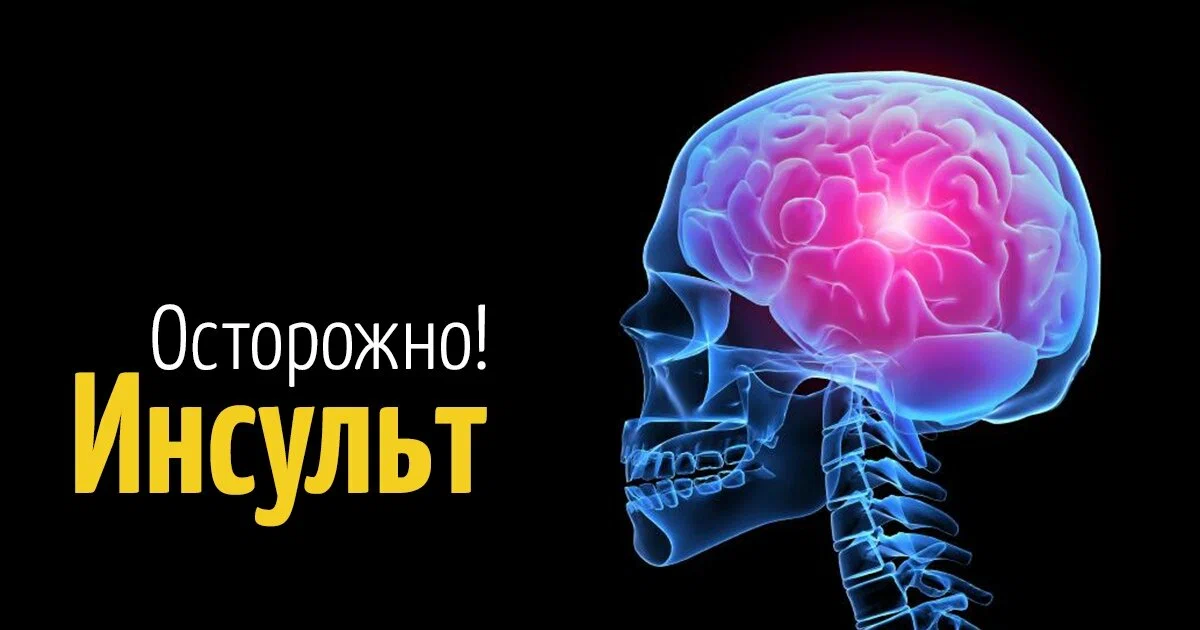 Мой микроинсульт в 23 года и вес 112 кг из за сидячей работы - 1