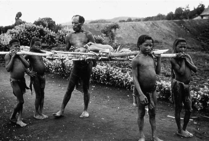 Аборигены форе несут больного куру ребёнка