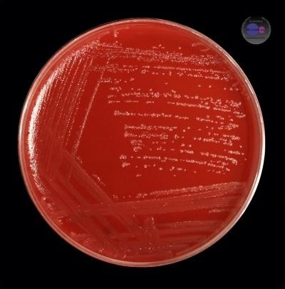 Культура возбудителя столбняка на КМПА Культура возбудителя столбняка на КМПА