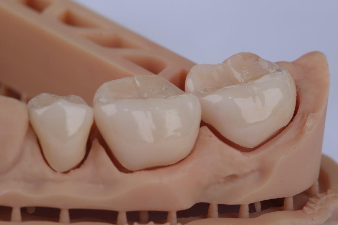 Как 3D-принтеры захватывают стоматологию и почему это прекрасно - 15