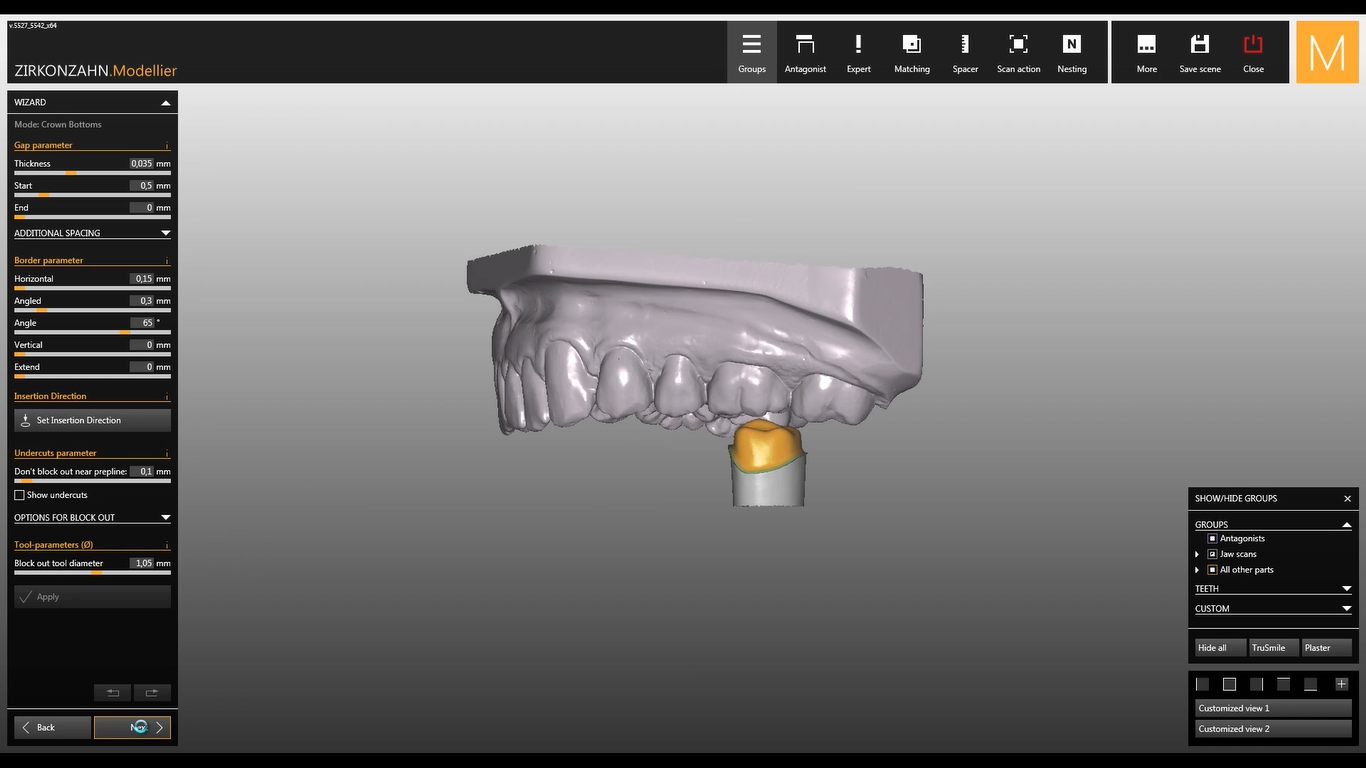 Как 3D-принтеры захватывают стоматологию и почему это прекрасно - 4