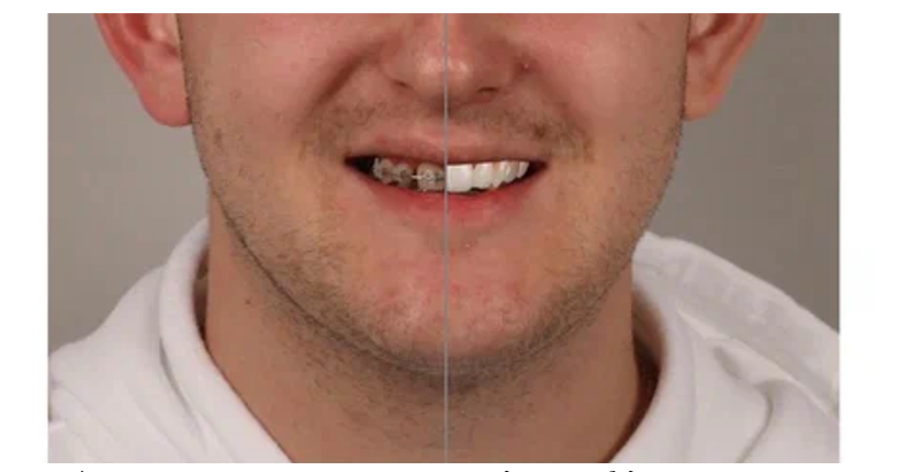 Как 3D-принтеры захватывают стоматологию и почему это прекрасно - 5
