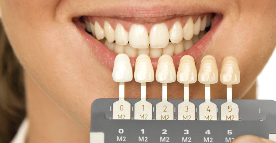 Заметки о зубной эмали и зубной пасте - 4
