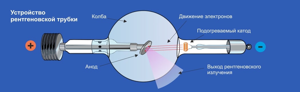 Компьютерная томография: от современной клиники до изучения древнего человека - 3