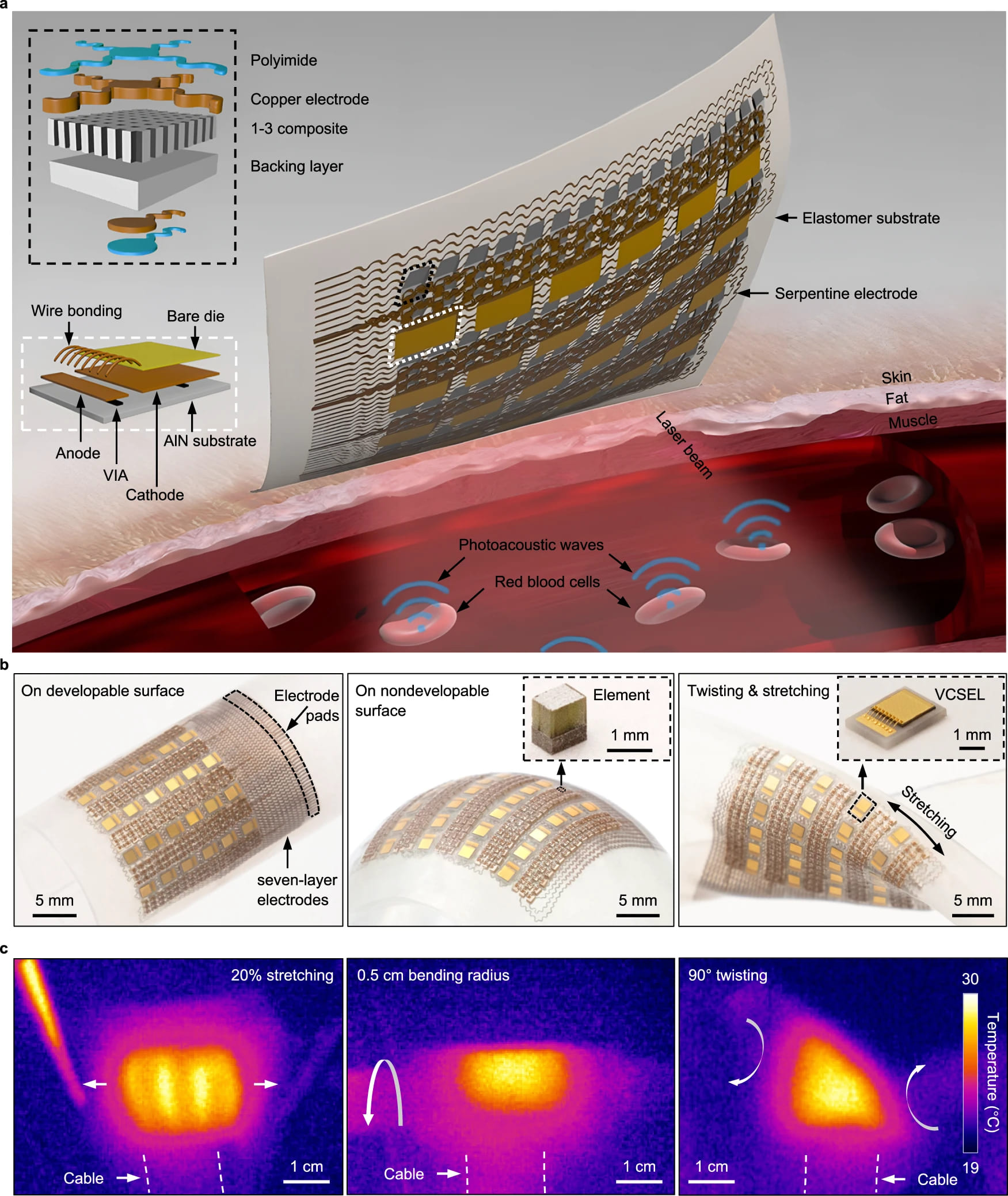 Умный пластырь: фотоакустика для мониторинга биомолекул в глубоких тканях - 2