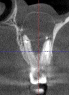 Медицинский случай, принёсший глубокое моральное удовлетворение - 10 image