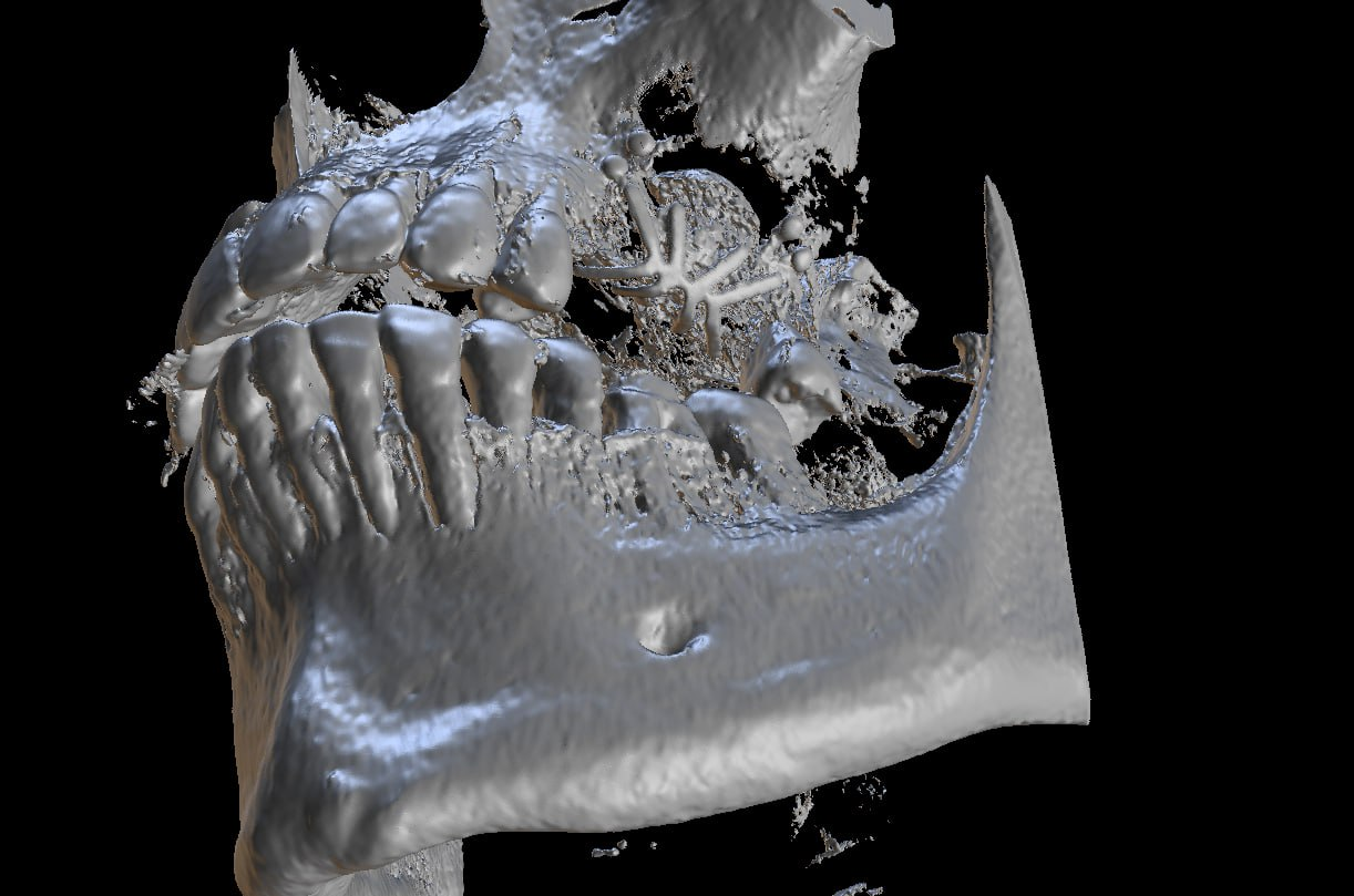 Медицинский случай, принёсший глубокое моральное удовлетворение - 4 image