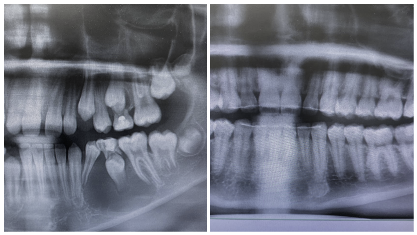 Медицинский случай, принёсший глубокое моральное удовлетворение - 8 image