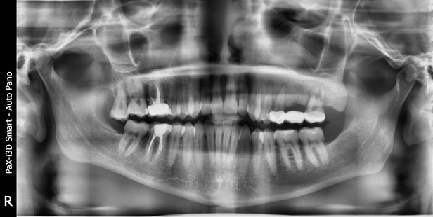 Дикие случаи с КТ со счастливым концом - 11 image