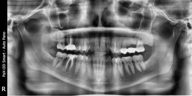 Дикие случаи с КТ со счастливым концом - 12 image