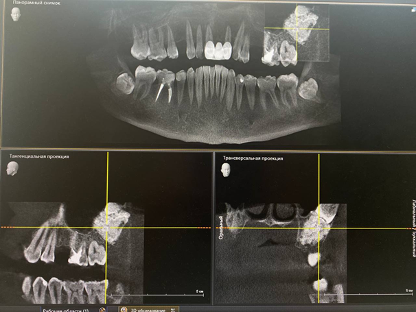 Дикие случаи с КТ со счастливым концом - 14 image