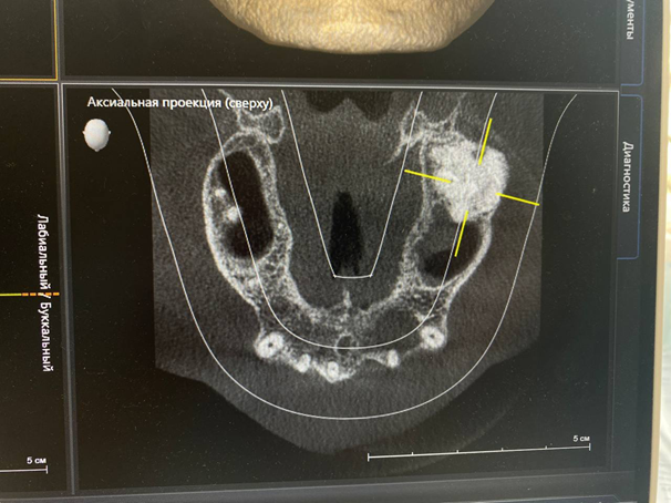 Дикие случаи с КТ со счастливым концом - 15 image